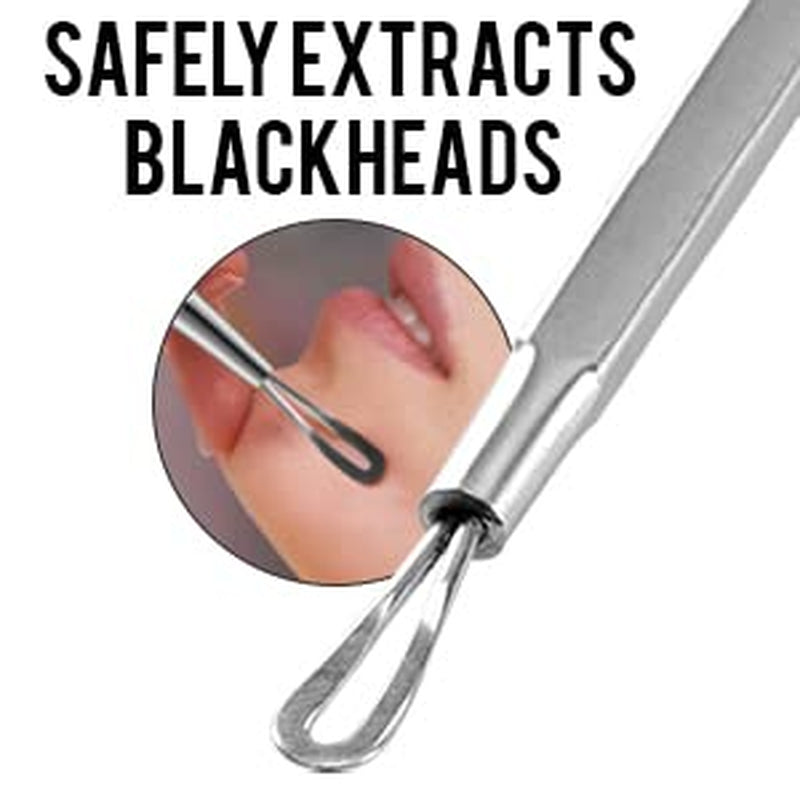 Blackhead Remover Pimple Popper Tool, Acne Comedone Extractor, Blemish Whitehead Zit Removing Tool for Nose Face, Stainless Steel