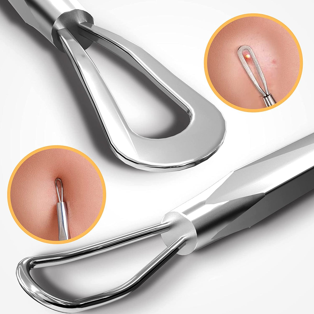 Blackhead Remover Pimple Popper Tool, Acne Comedone Extractor, Blemish Whitehead Zit Removing Tool for Nose Face, Stainless Steel